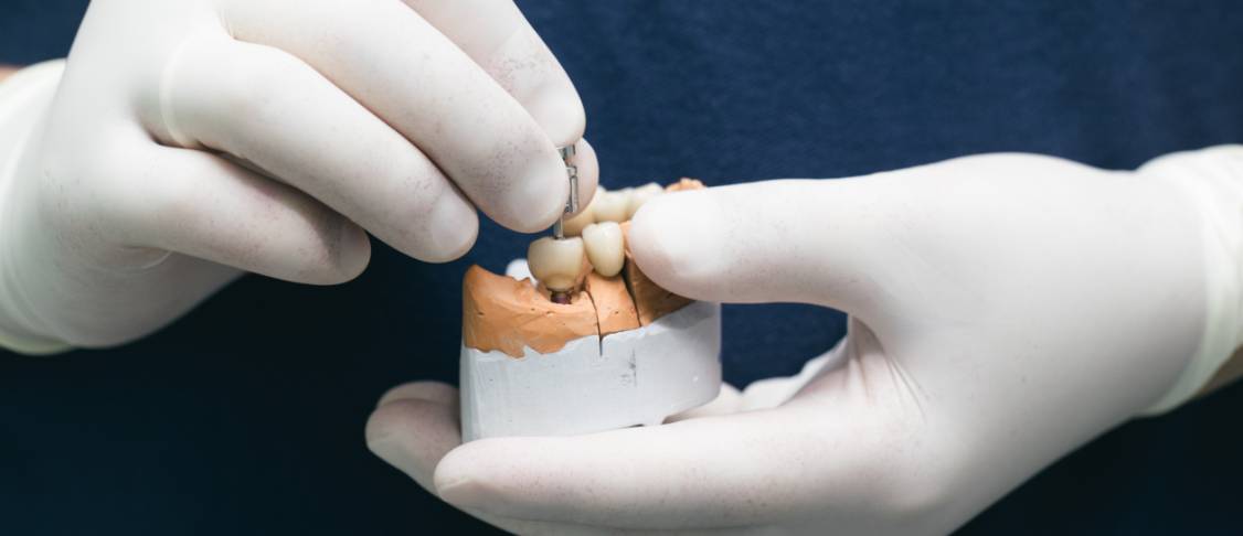 dental implant img dental implant img