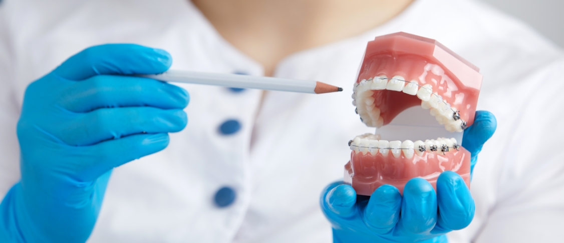 dental retainers img dental retainers img