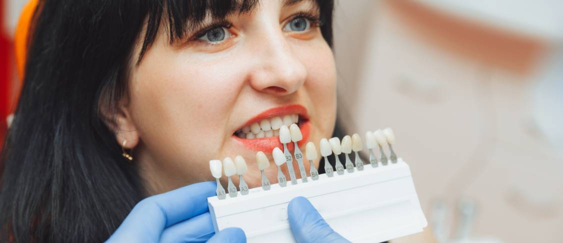 dental veneers img