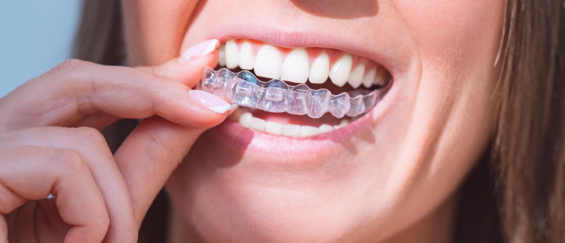 orthodontic dentistry img